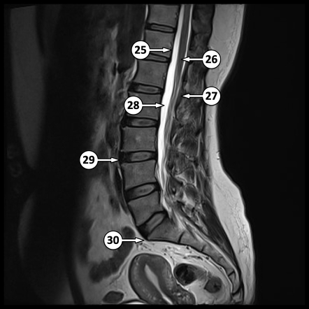 Images | Radiopaedia.org