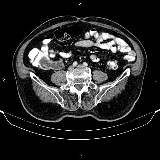 Image | Radiopaedia.org