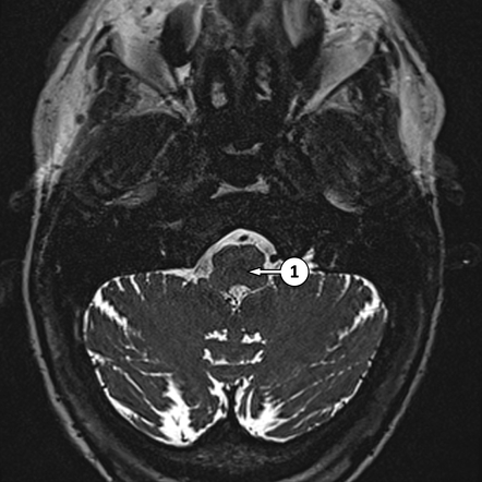 Radiology Quiz 187268 | Radiopaedia.org