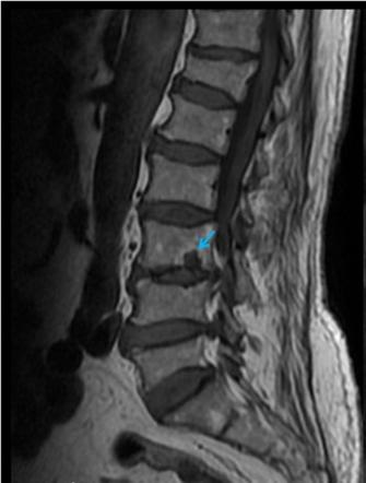 Viewing playlist: Paediatrics - Spine | Radiopaedia.org