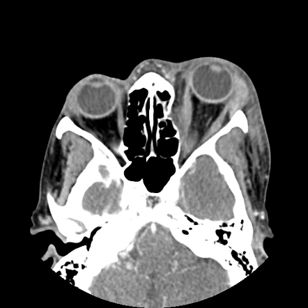 Image | Radiopaedia.org