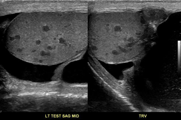 Images | Radiopaedia.org