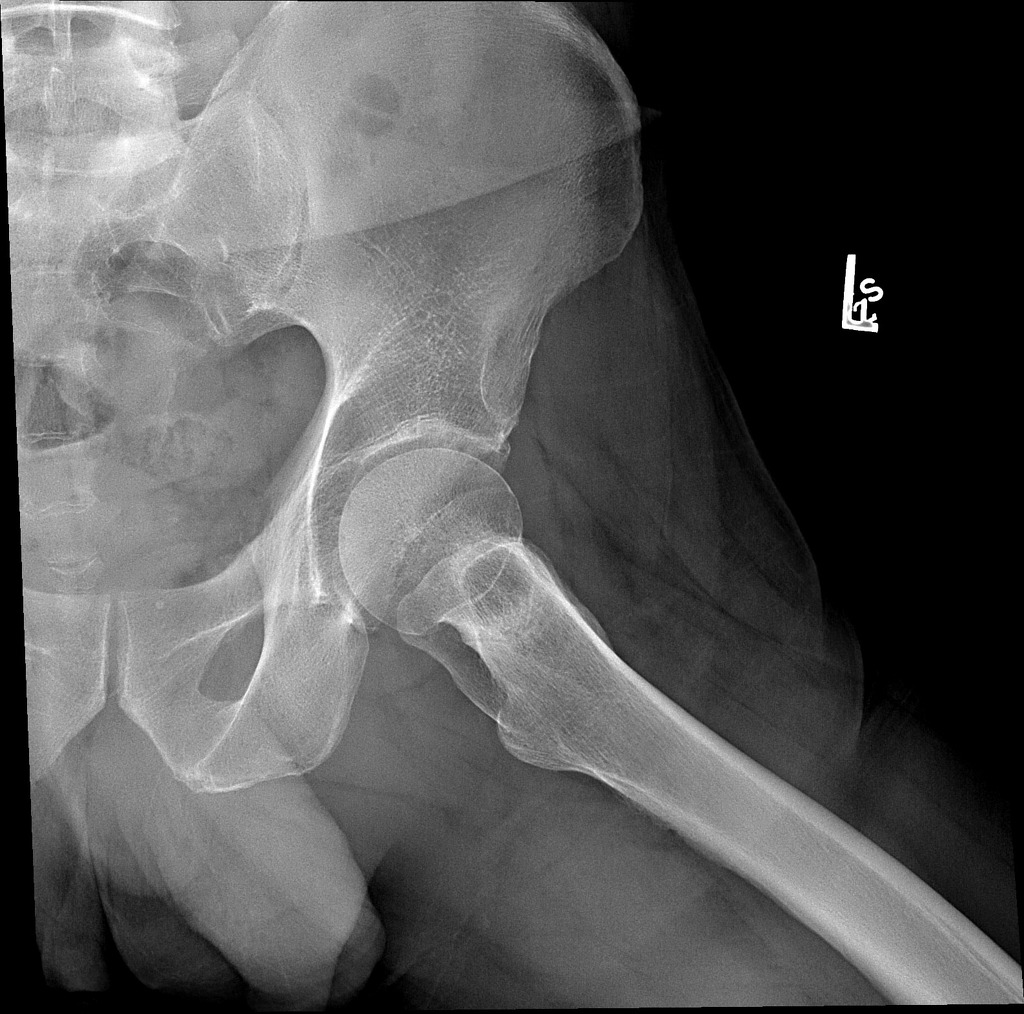 Radiology Quiz 28666 | Radiopaedia.org