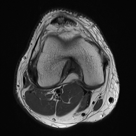 Images | Radiopaedia.org