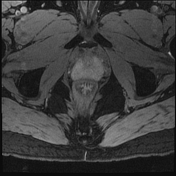 case study for ob