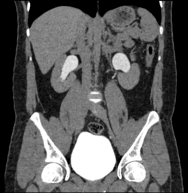 Images | Radiopaedia.org