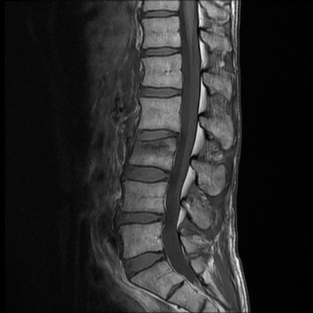 Images | Radiopaedia.org