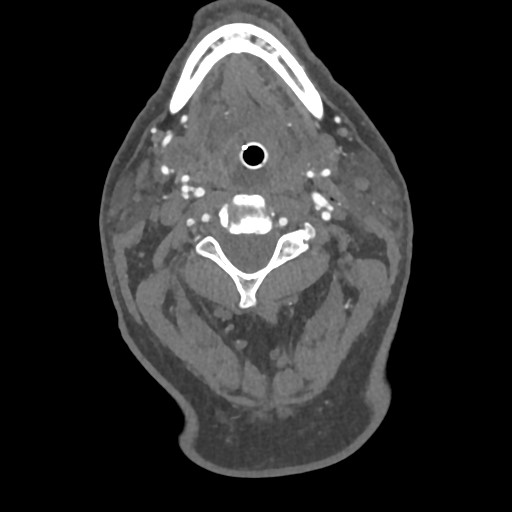 Image | Radiopaedia.org