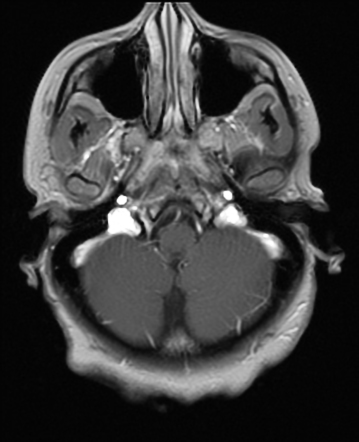 Images | Radiopaedia.org