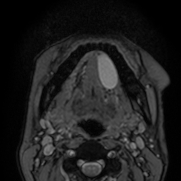 Images | Radiopaedia.org