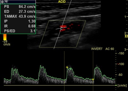 Image | Radiopaedia.org