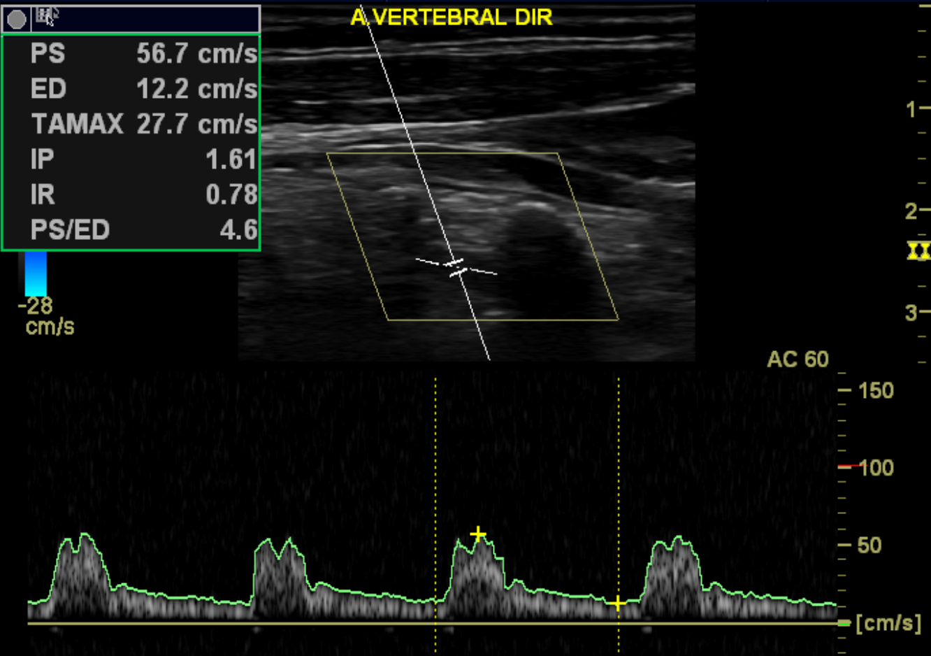 Image | Radiopaedia.org