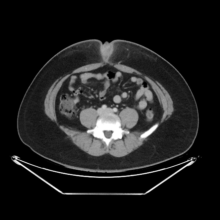 Images | Radiopaedia.org