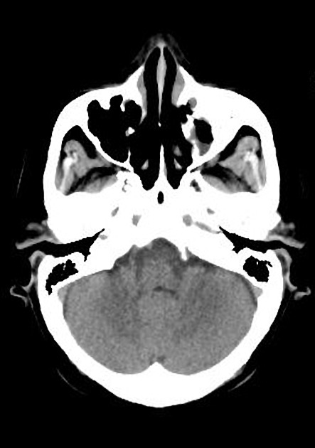 Radiology Quiz 28827 | Radiopaedia.org