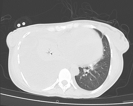 Images | Radiopaedia.org