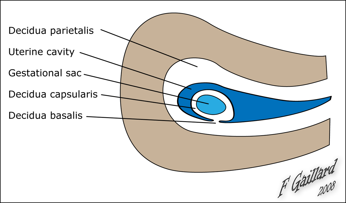 Image | Radiopaedia.org