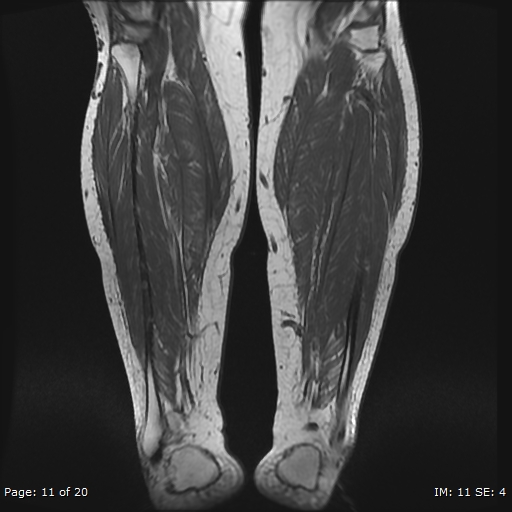 Radiology Quiz 29127 | Radiopaedia.org