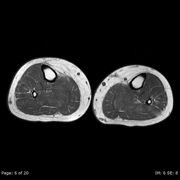 Radiology Quiz 29127 | Radiopaedia.org