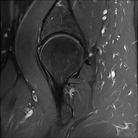 Radiology Quiz 202833 | Radiopaedia.org