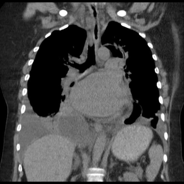 Radiology Quiz 29213 | Radiopaedia.org