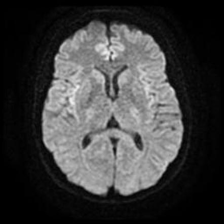 Viewing playlist: Lecture: Pituitary - Cases | Radiopaedia.org