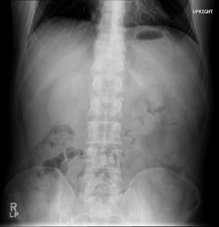 Viewing playlist: FRCR 2B Cases | Radiopaedia.org