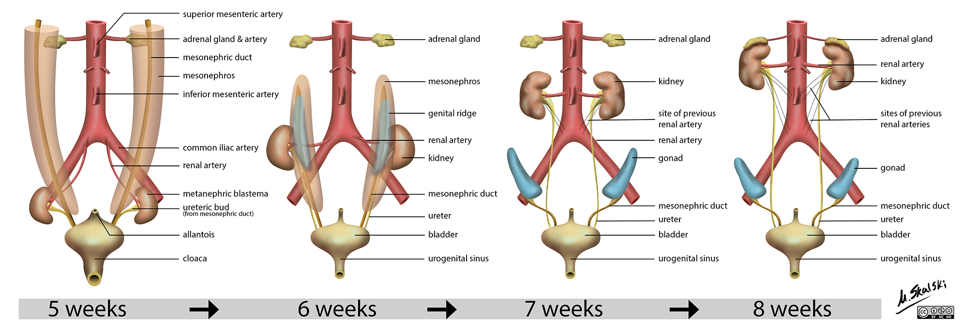 Developmental anatomy - renal | Image | Radiopaedia.org