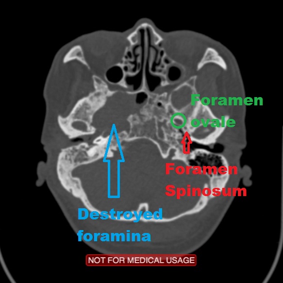 Image | Radiopaedia.org