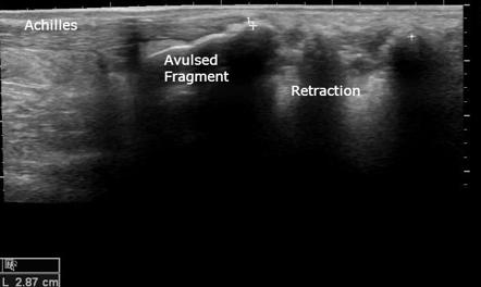 Image | Radiopaedia.org