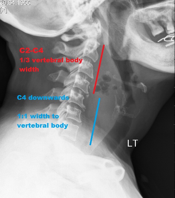 Image | Radiopaedia.org