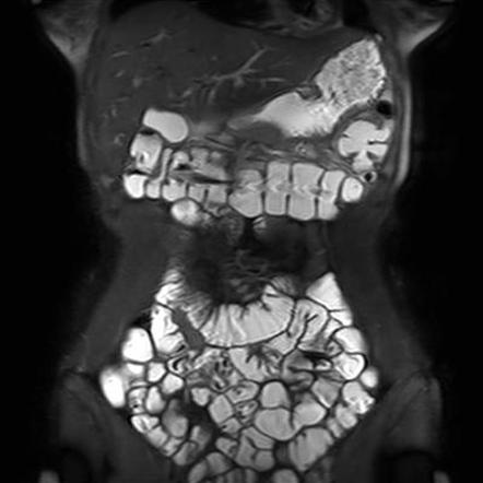 enterography radiology radiopaedia