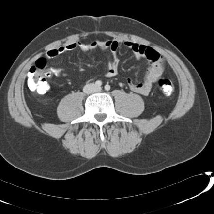 Playlist 'Anatomy' by dr sameh saad