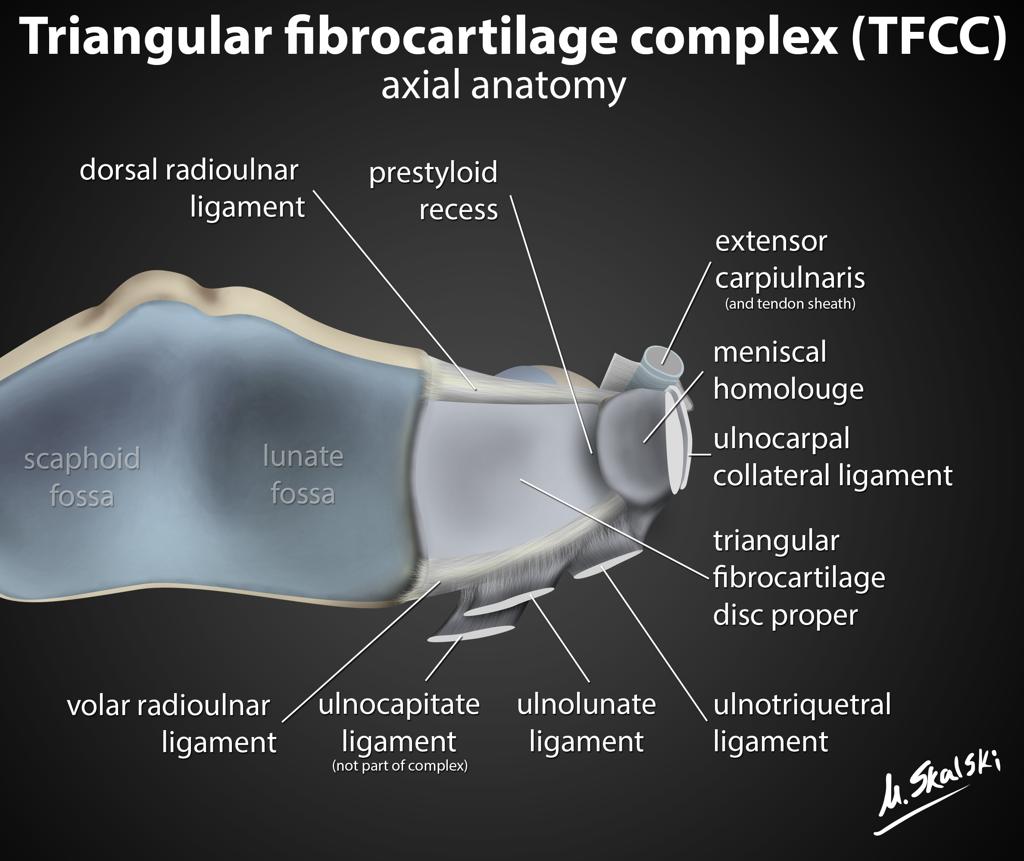 fibrocartilage diagram