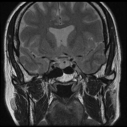 Playlist 'Lecture: Pituitary - Cases' by Assoc Prof Frank Gaillard