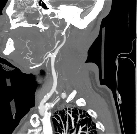 Viewing playlist: Neuro | Radiopaedia.org