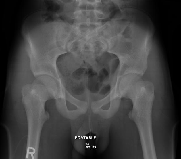 Pelvic radiograph (an approach)  Radiology Reference Article