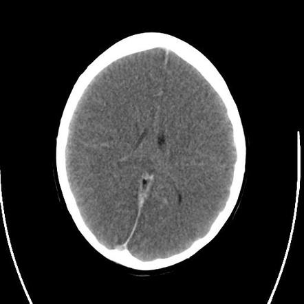 Radiology Quiz 31166 | Radiopaedia.org