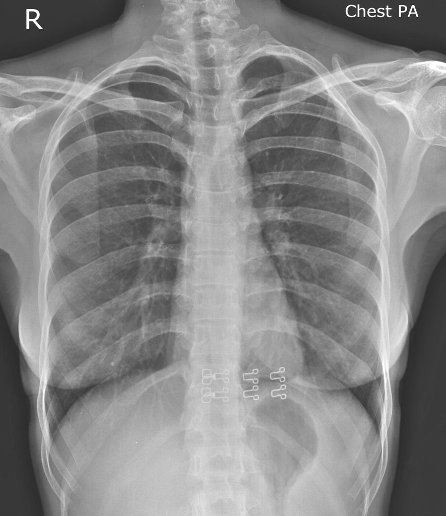 Radiology Quiz 31199 | Radiopaedia.org