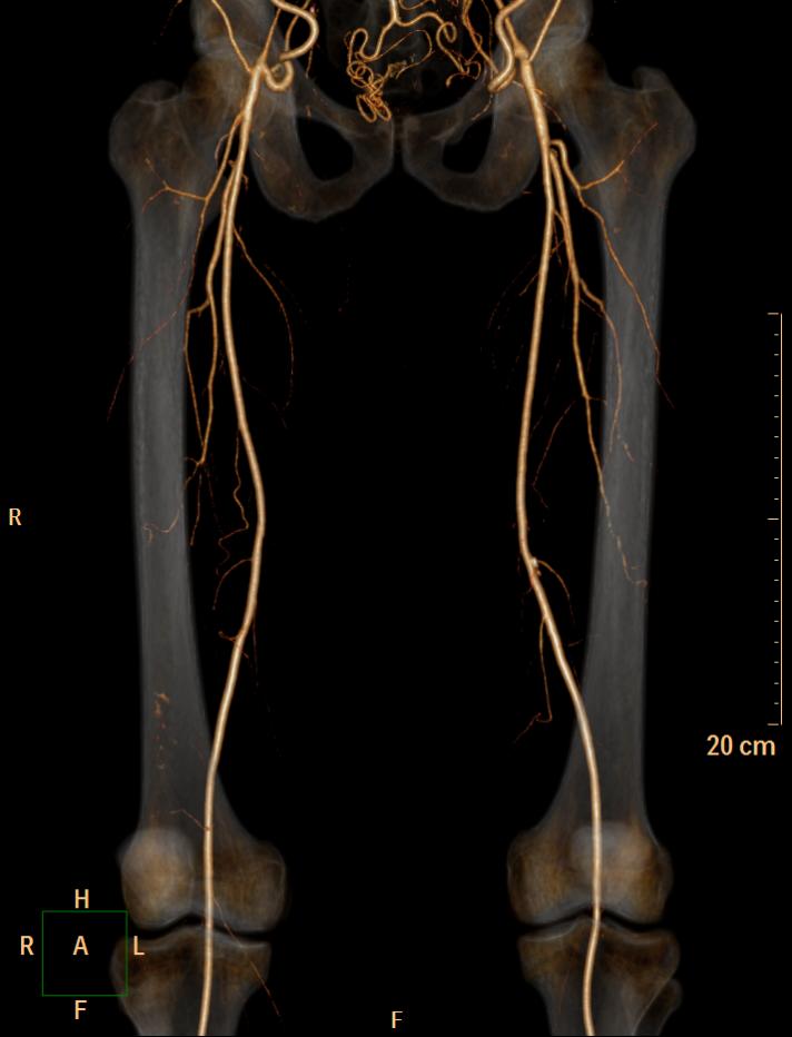 Image | Radiopaedia.org