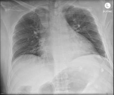 Viewing playlist: CHR 663L Lesson 8: Chest Imaging | Radiopaedia.org