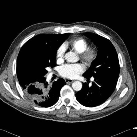 Viewing playlist: long cases | Radiopaedia.org