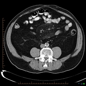 Details more than 55 fat ring sign best - vova.edu.vn