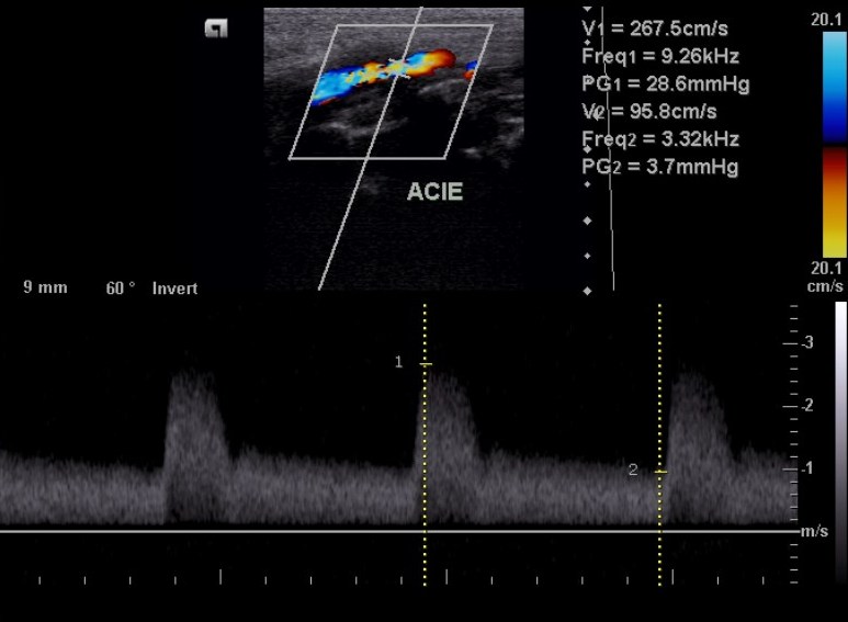 Image | Radiopaedia.org