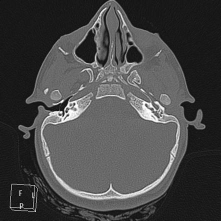 Image | Radiopaedia.org