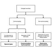 Hydrocephalus | Radiology Reference Article | Radiopaedia.org