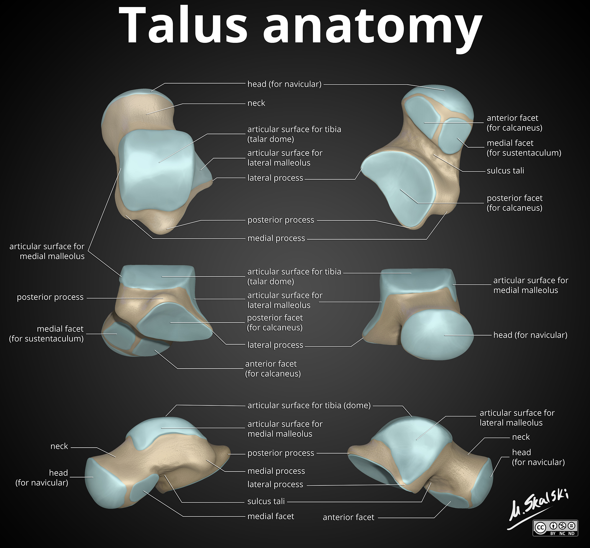 Anatomy Of The Talus Image Radiopaedia Org