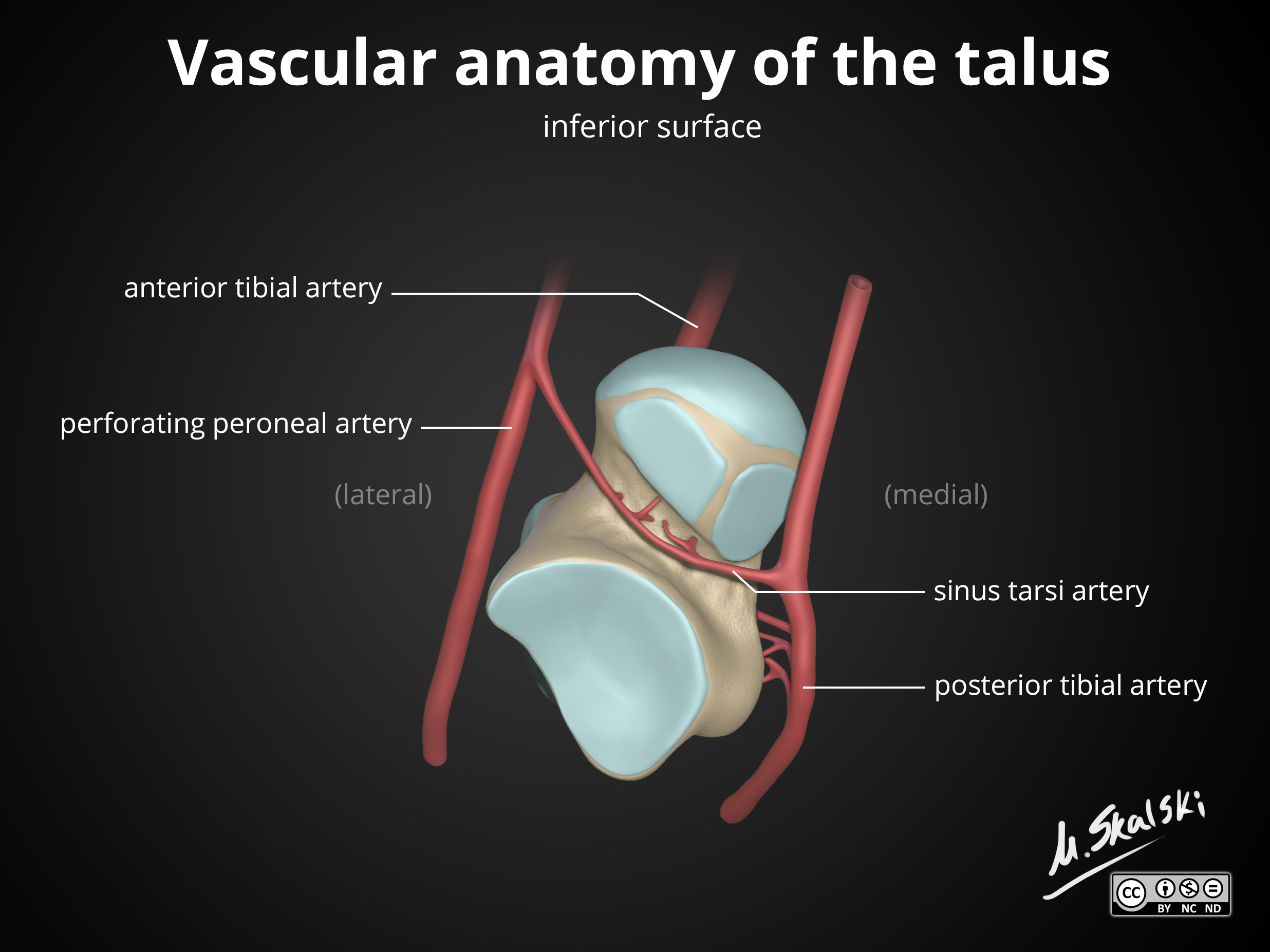 Image | Radiopaedia.org