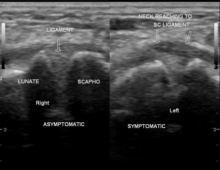 Image | Radiopaedia.org