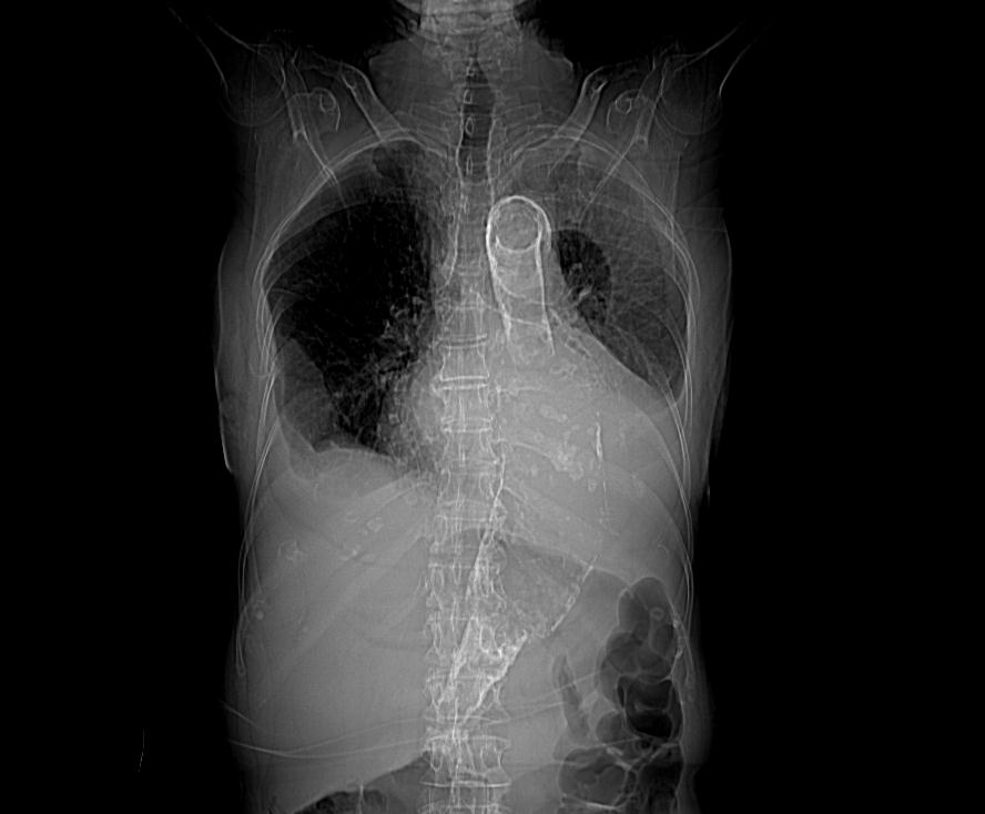 Aorta oh слив фото