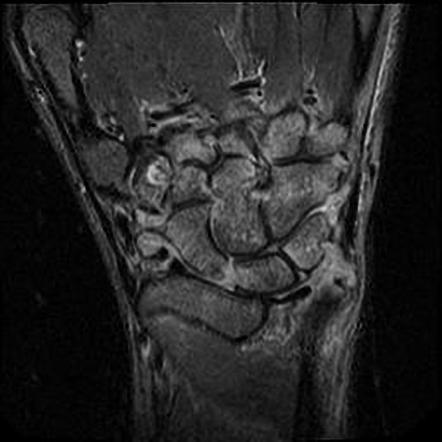 Viewing playlist: MRI Wrist | Radiopaedia.org